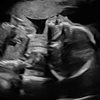 Babylist Registry Photo.