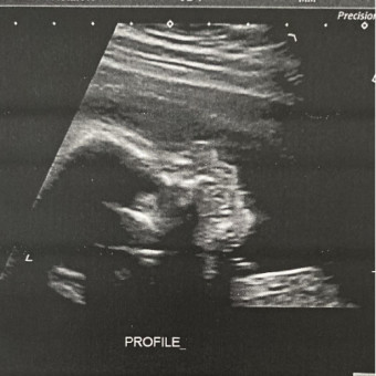 Babylist Registry Photo.