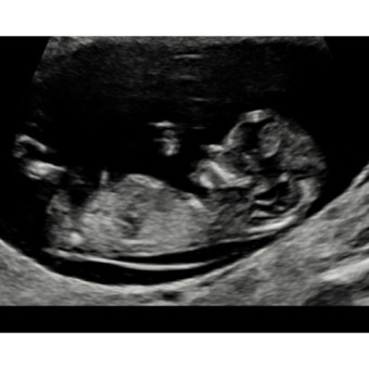 Babylist Registry Photo.