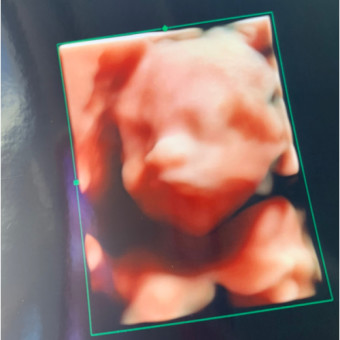 Babylist Registry Photo.