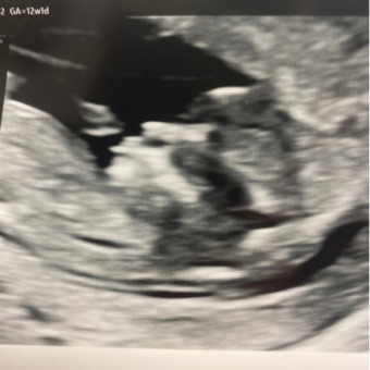 Babylist Registry Photo.