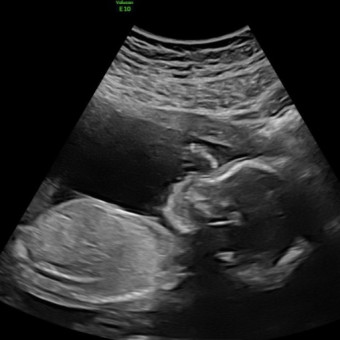 Babylist Registry Photo.