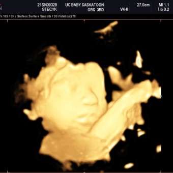 Babylist Registry Photo.
