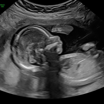 Babylist Registry Photo.