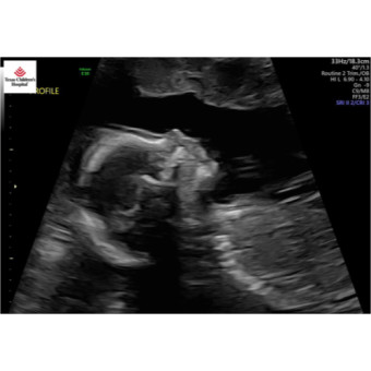 Babylist Registry Photo.