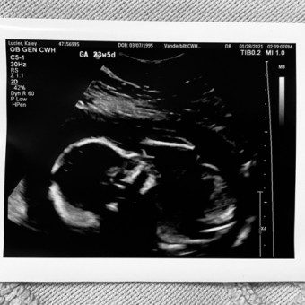 Babylist Registry Photo.