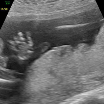 Babylist Registry Photo.