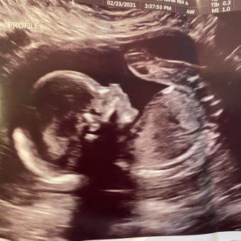 Babylist Registry Photo.