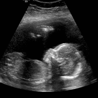 Babylist Registry Photo.