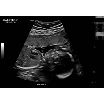 Babylist Registry Photo.