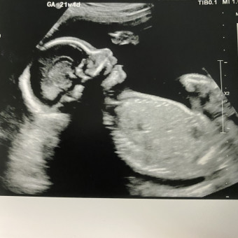 Babylist Registry Photo.