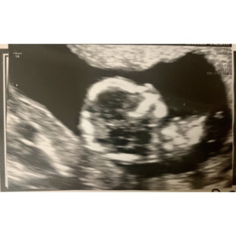 Babylist Registry Photo.