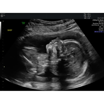 Babylist Registry Photo.