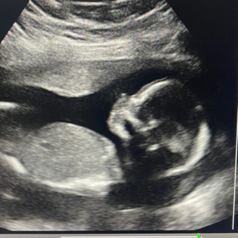 Babylist Registry Photo.