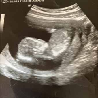 Babylist Registry Photo.