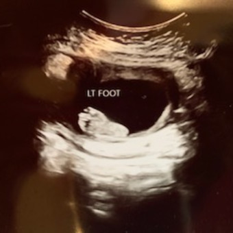 Babylist Registry Photo.