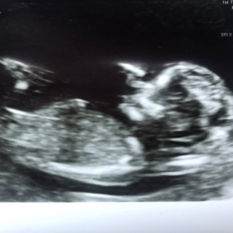 Babylist Registry Photo.