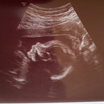 Babylist Registry Photo.