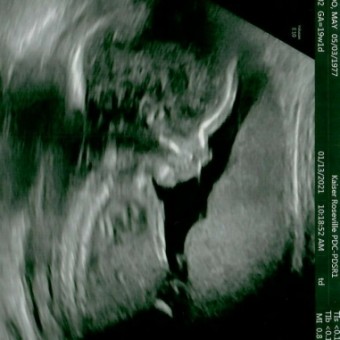 Babylist Registry Photo.
