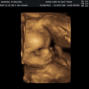 Babylist Registry Photo.
