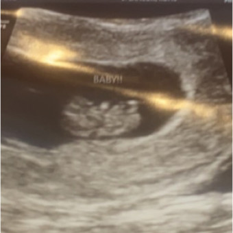 Babylist Registry Photo.