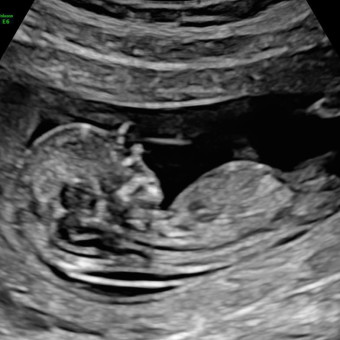 Babylist Registry Photo.