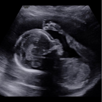 Babylist Registry Photo.
