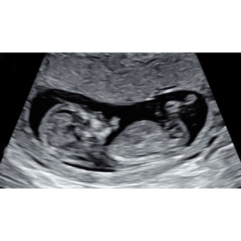 Babylist Registry Photo.