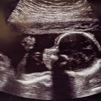 Babylist Registry Photo.
