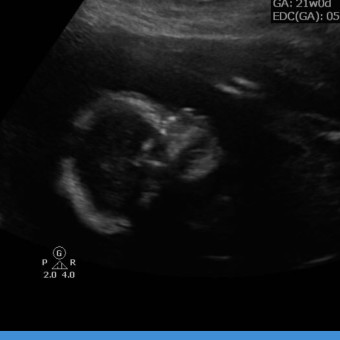 Babylist Registry Photo.