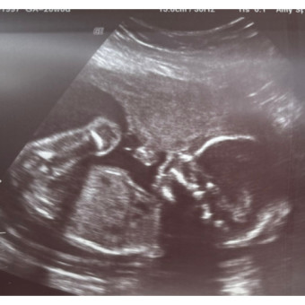 Babylist Registry Photo.