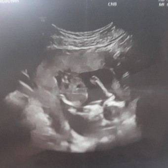 Babylist Registry Photo.