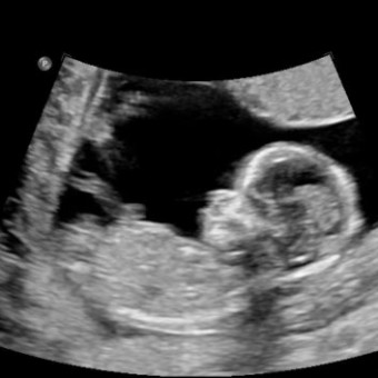 Babylist Registry Photo.
