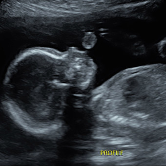 Babylist Registry Photo.
