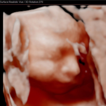 Babylist Registry Photo.