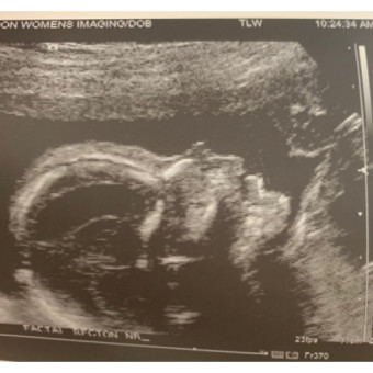 Babylist Registry Photo.