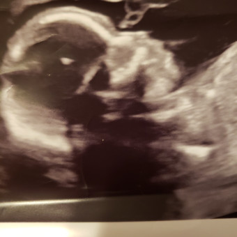 Babylist Registry Photo.