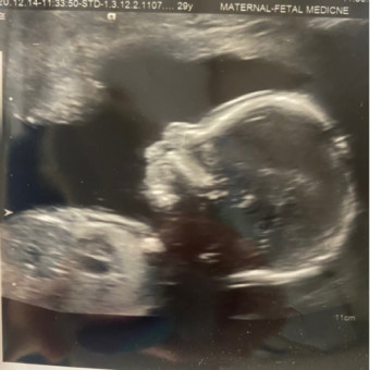 Babylist Registry Photo.