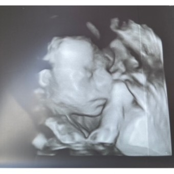 Babylist Registry Photo.