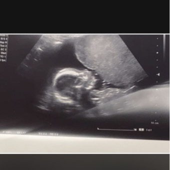 Babylist Registry Photo.