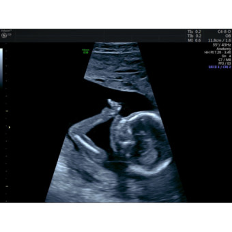Babylist Registry Photo.