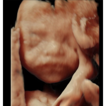 Babylist Registry Photo.