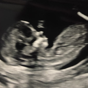 Babylist Registry Photo.