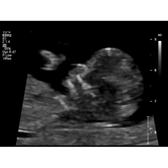Babylist Registry Photo.