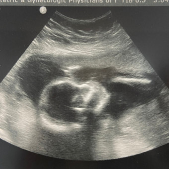 Babylist Registry Photo.