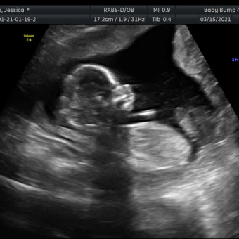 Babylist Registry Photo.