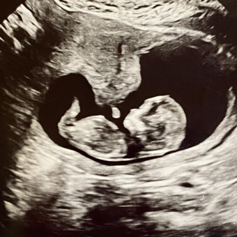 Babylist Registry Photo.