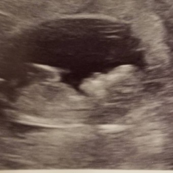 Babylist Registry Photo.