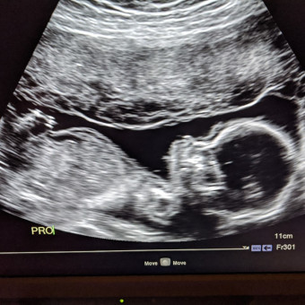Babylist Registry Photo.