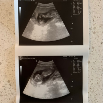 Babylist Registry Photo.